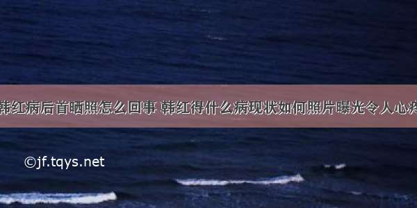 韩红病后首晒照怎么回事 韩红得什么病现状如何照片曝光令人心疼